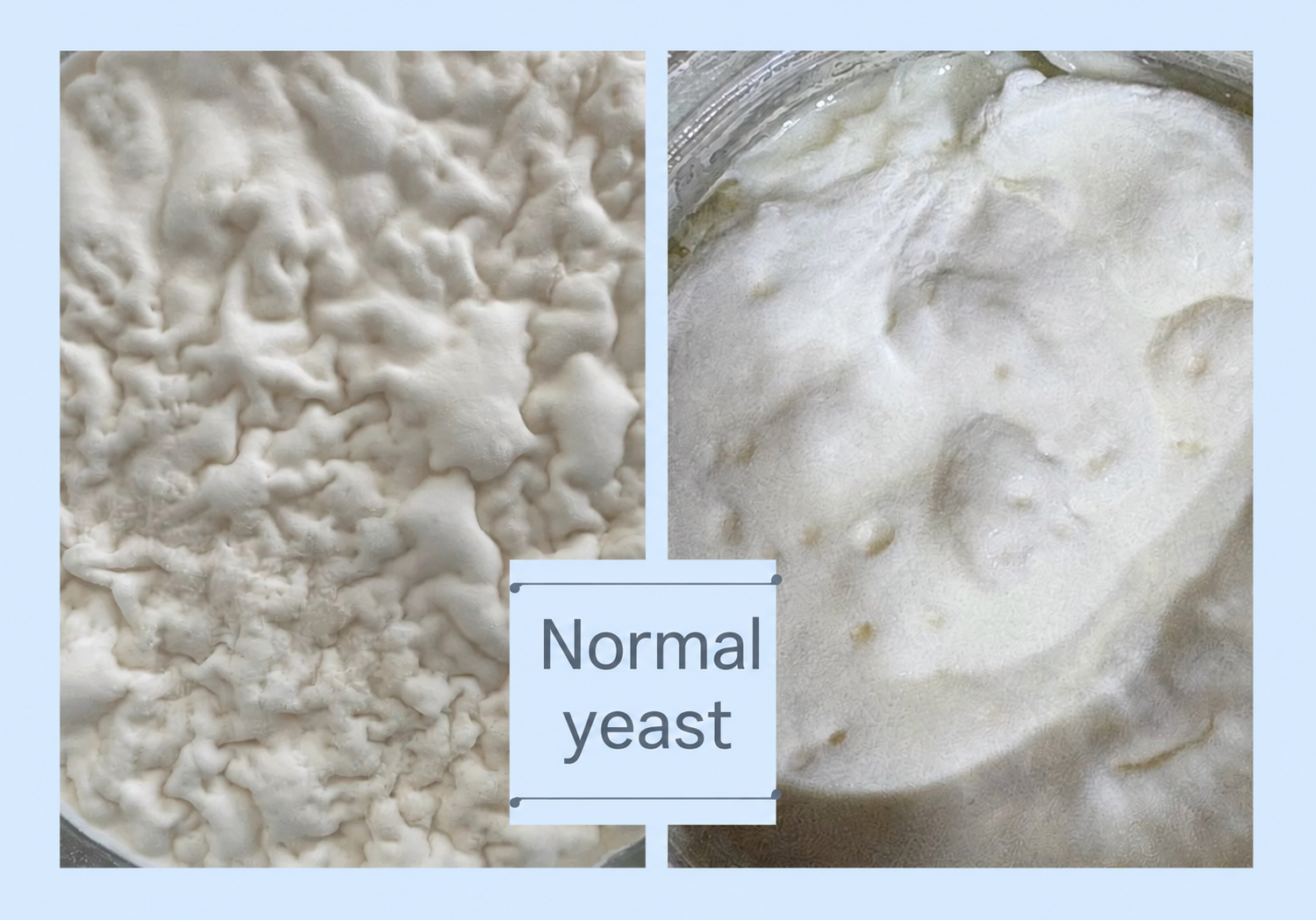Normal yeast